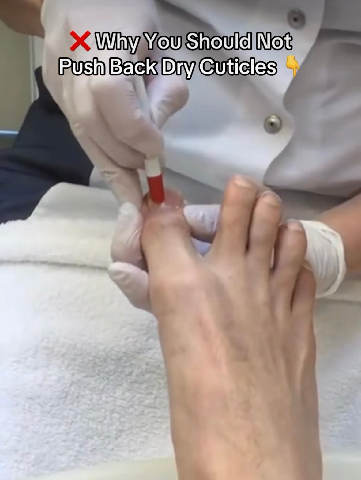 Why You Should Never Push Back Dry Cuticles