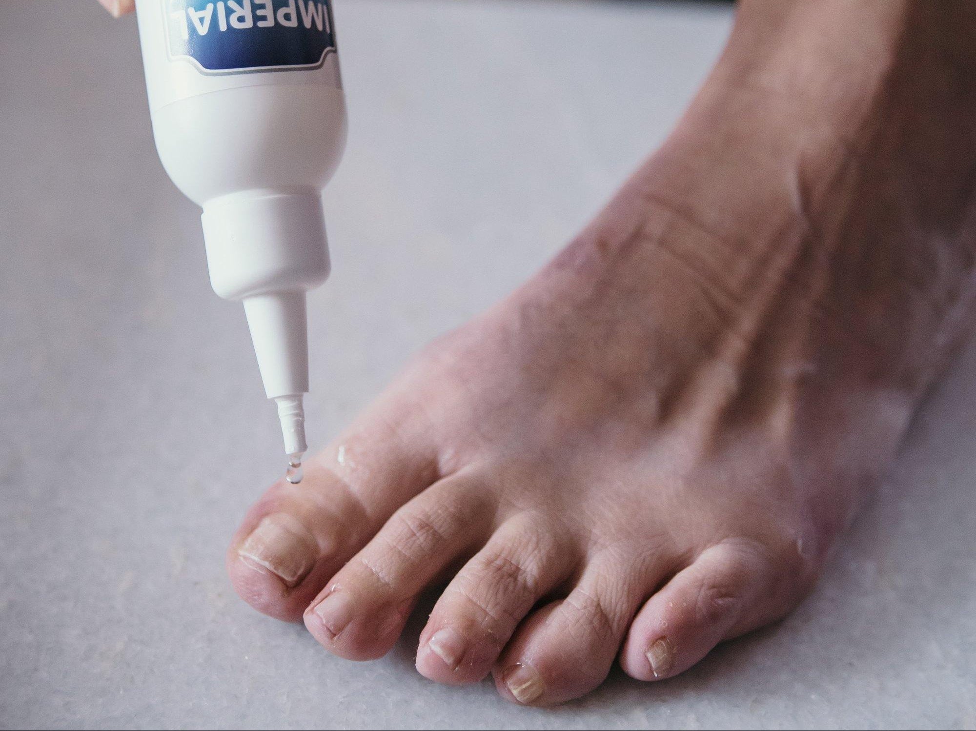 How to Get Rid of Yellow Toenails Fast