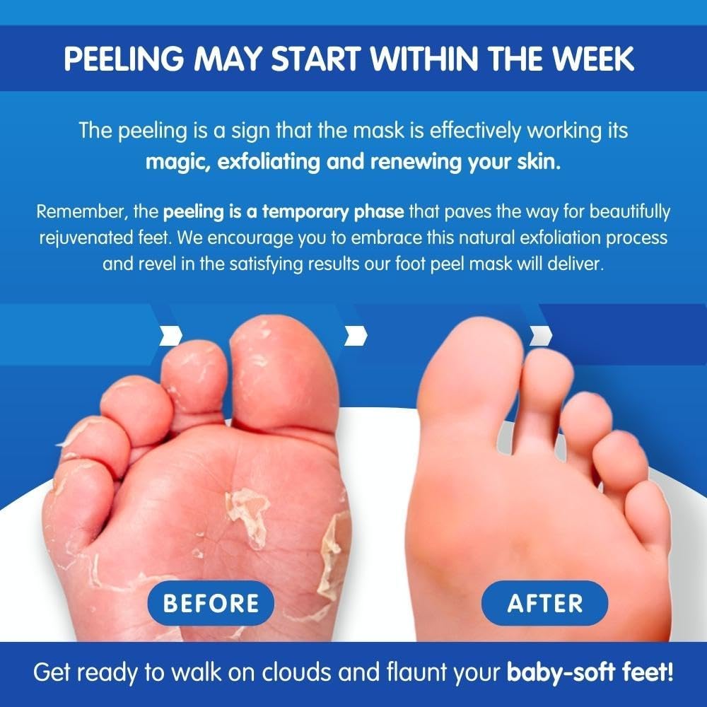 NEW: Peeling Foot Mask (2x)