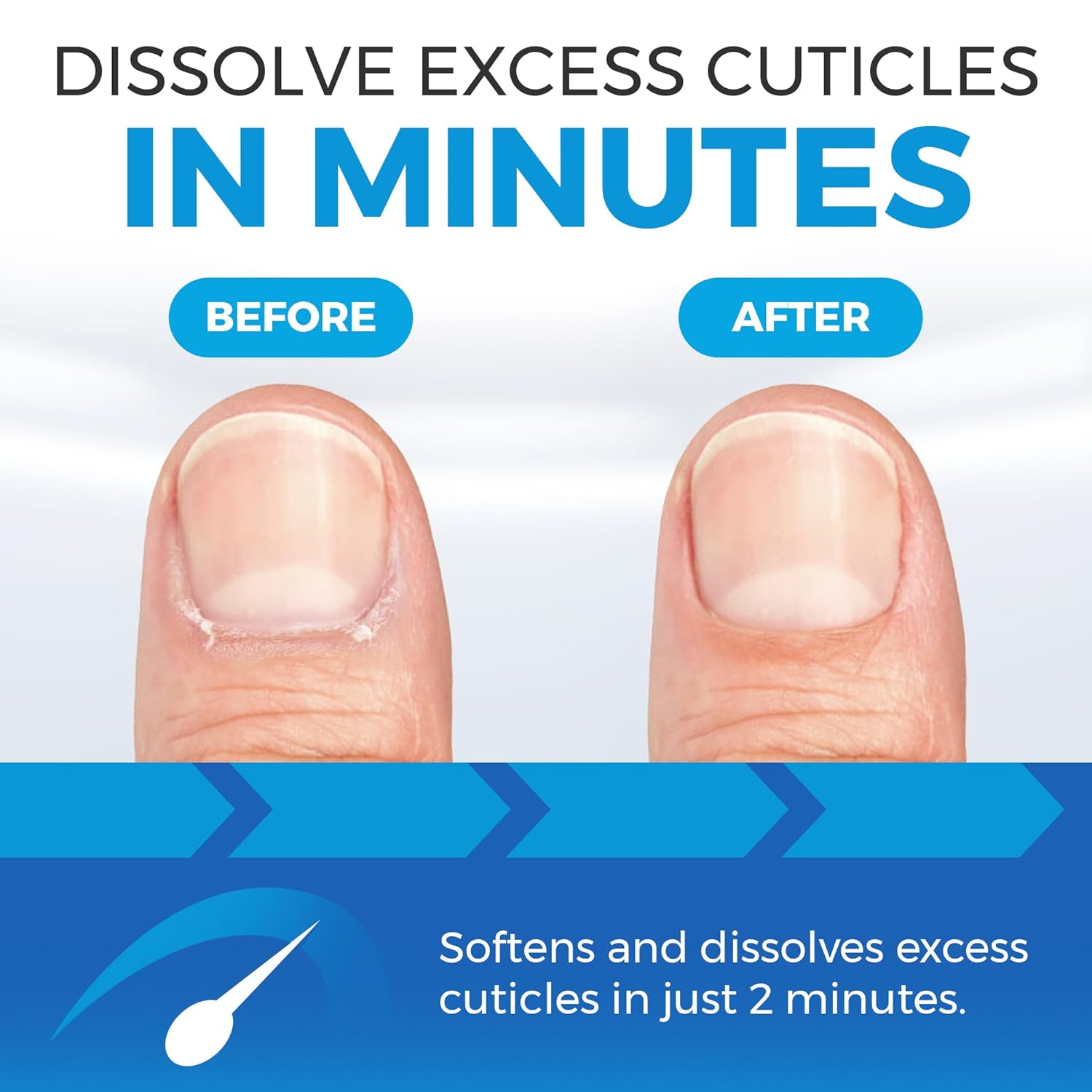 Cuticle Oil