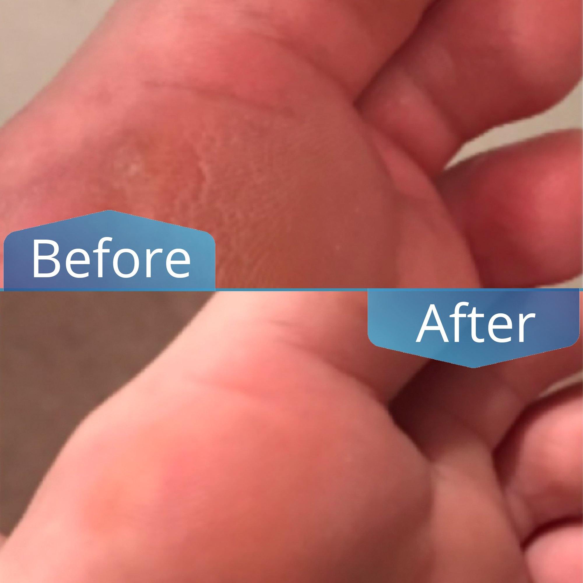 Honey Balm - Imperial Feet - Foot care products - B2C, Dry and Cracked Feet, Extra Care