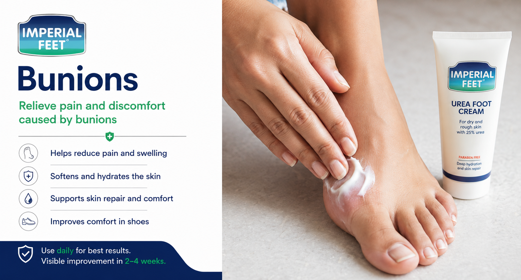 Bunions: Causes, Symptoms, and Non-Surgical Management