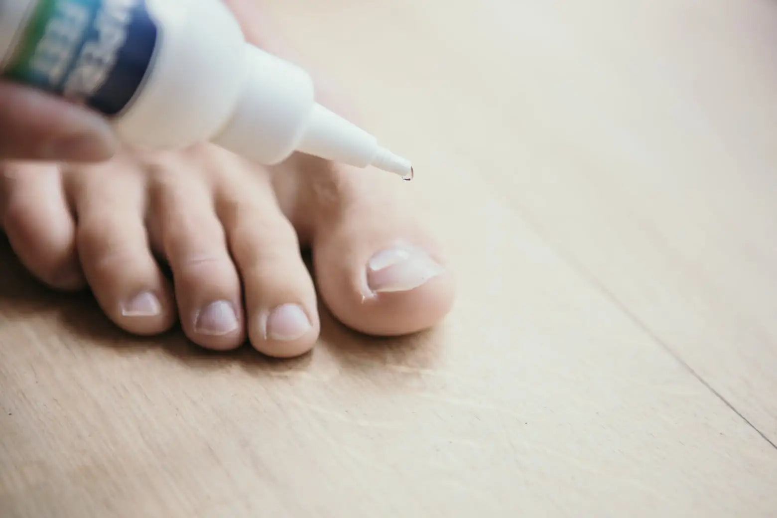 How to Get Rid of Athlete's Foot Fast