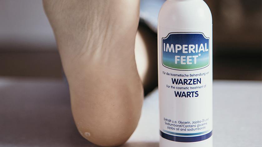 How to get rid of a plantar wart - Imperial Feet - 