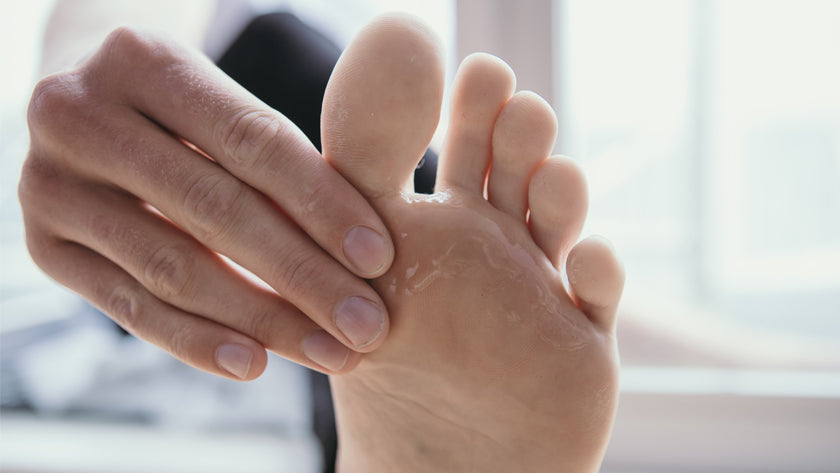 Athlete's foot