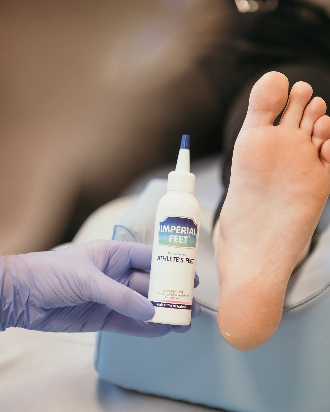Athlete's Foot: Causes, Symptoms, and Treatment