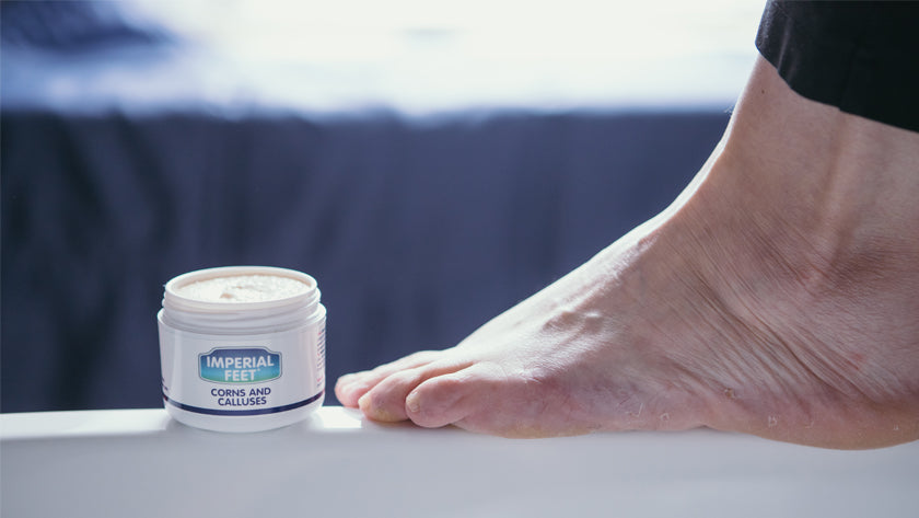 How to treat corn and calluses