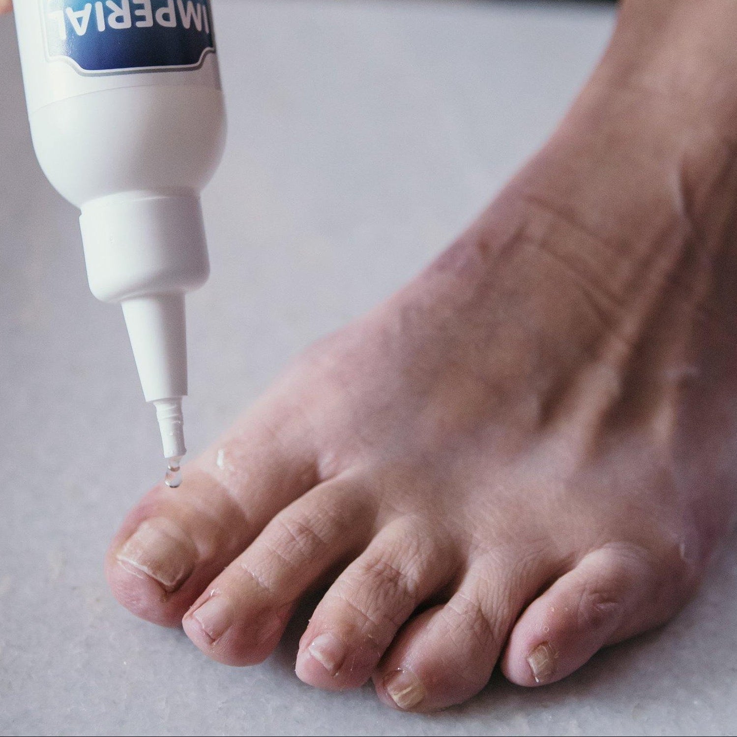 Fungal Nail Treatment