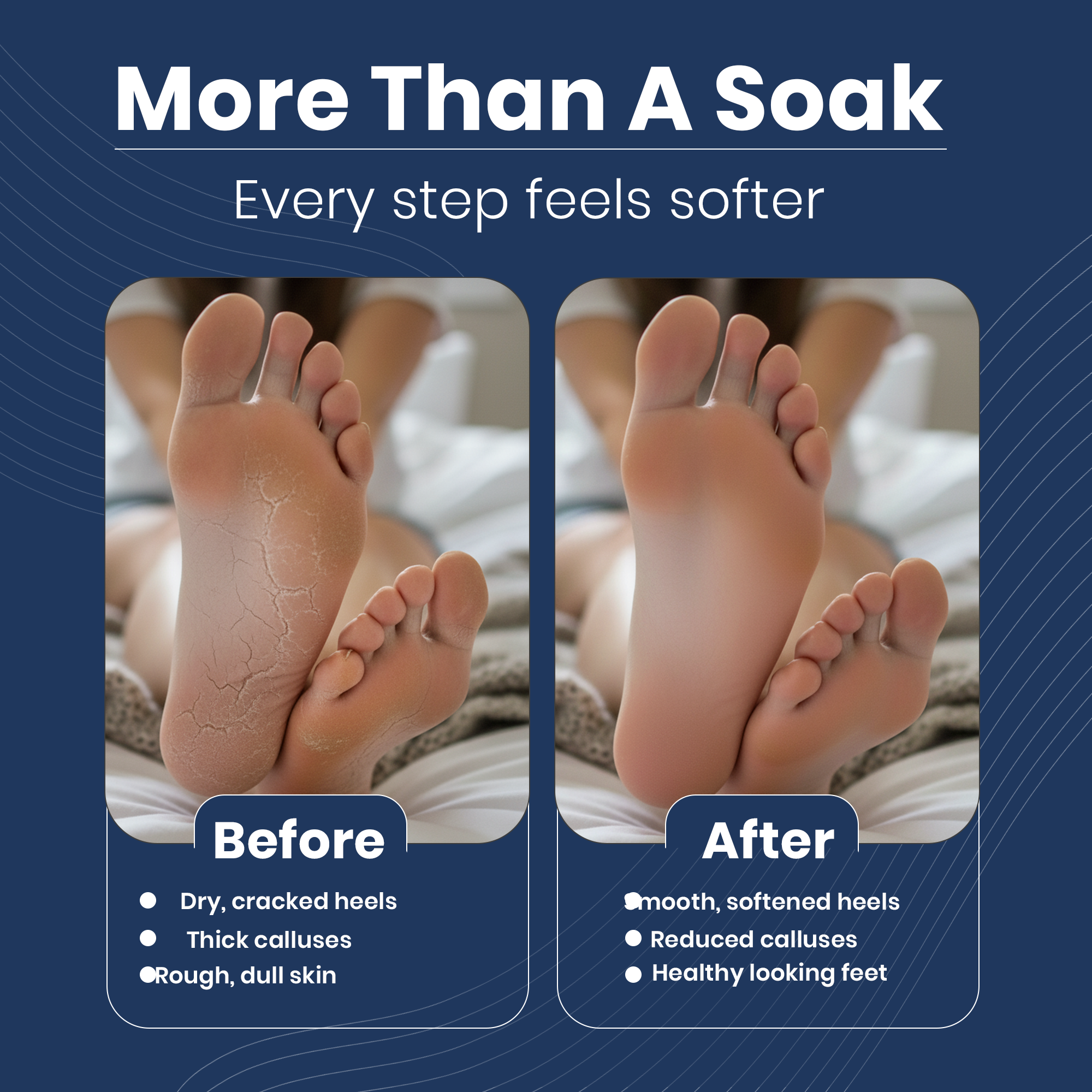 cracked heels before and after ettects
