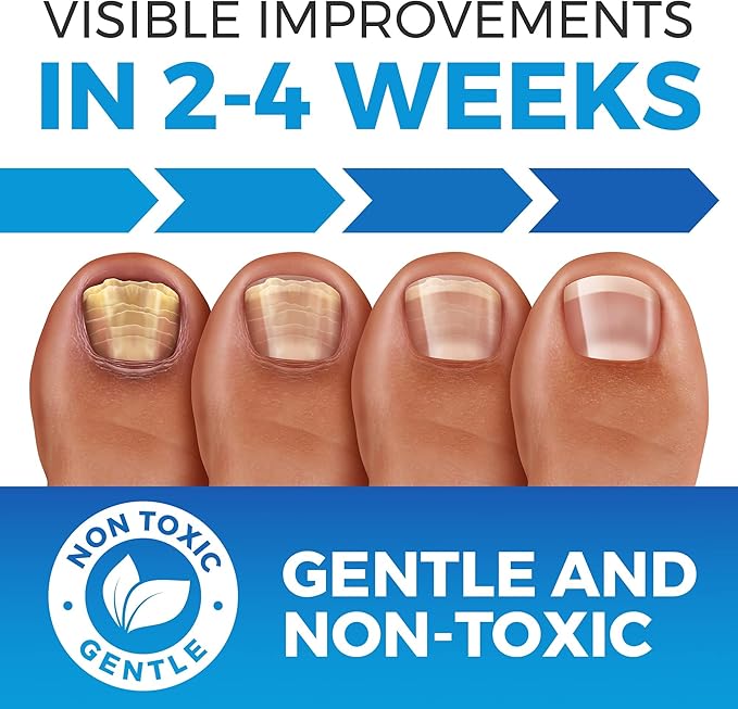 Professional-Grade Nail Fungus Treatment - Mockup